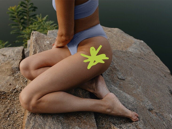hip fratures vegetarian 732x549 thumbnail 1 732x549 IkeUVt